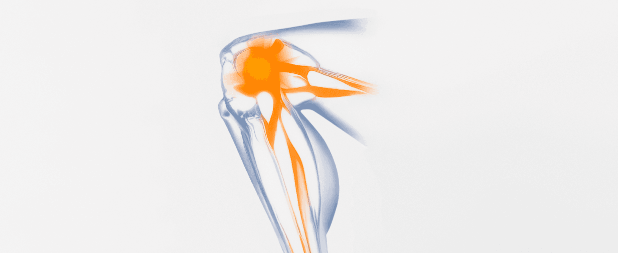 LRC knee